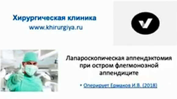 Лапароскопическая аппендэктомия при остром флегмонозном аппендиците: преимущества метода фото 1