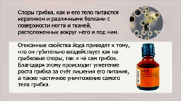 Эффективное дешевое средство от грибка ногтей на ногах уходпрепаратаптека фото 3
