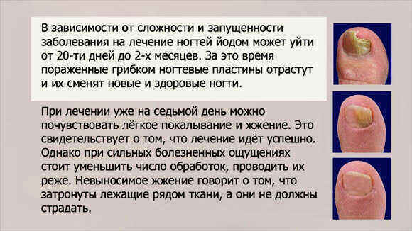 Эффективное дешевое средство от грибка ногтей на ногах уходпрепаратаптека фото 6