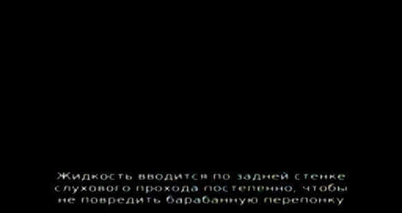 Как правильно промыть ухо от серной пробки в домашних условиях фото 3
